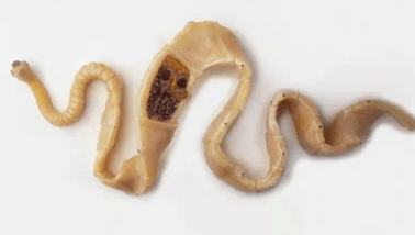 Cómo descubrir la presencia de parásitos en el cuerpo