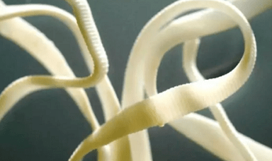 Cómo eliminar los parásitos del cuerpo humano